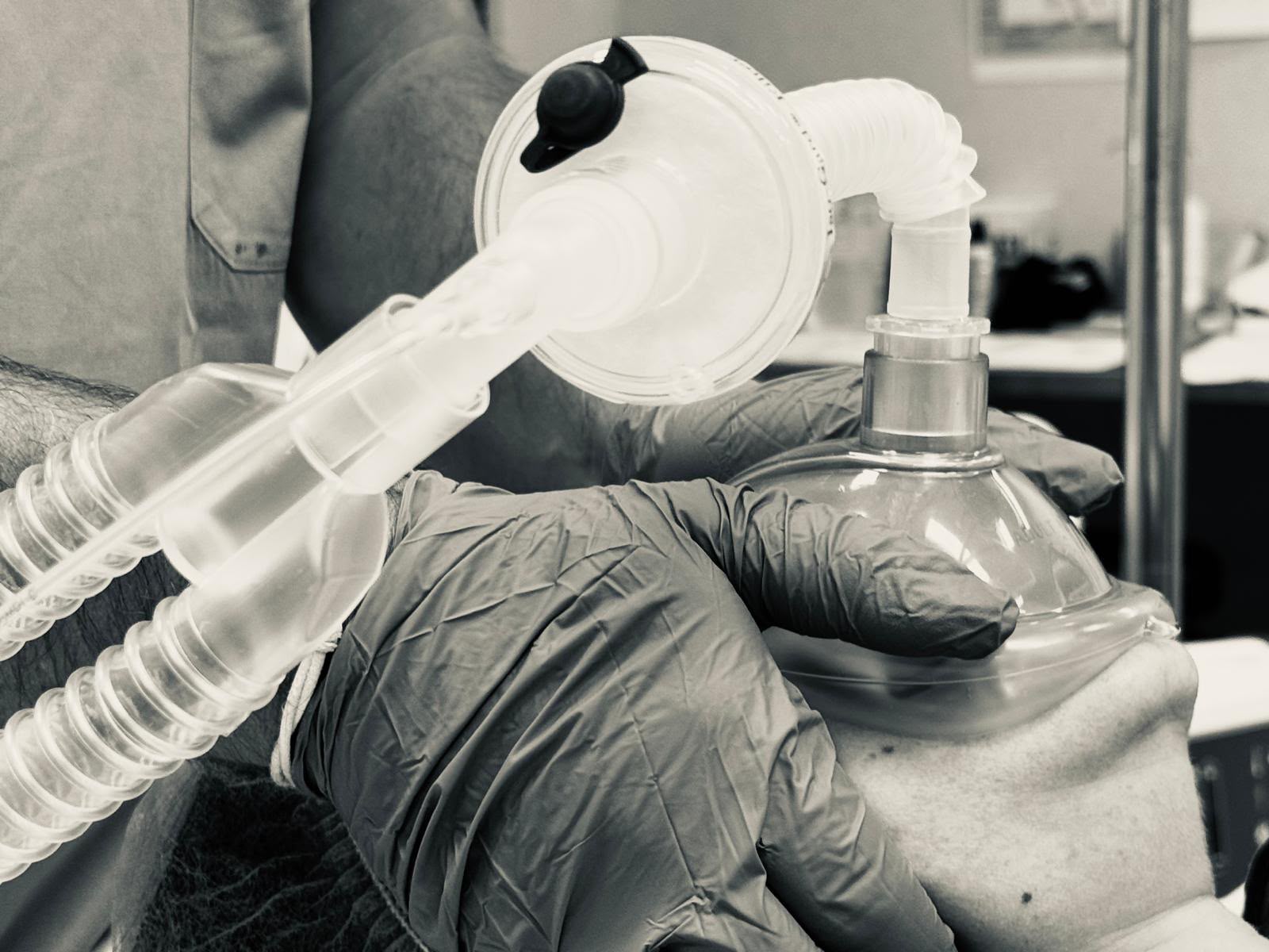 Masque d'anesthésie appliqué sur le visage du patient et raccordé au circuit de ventilation — induction d'une anesthésie générale